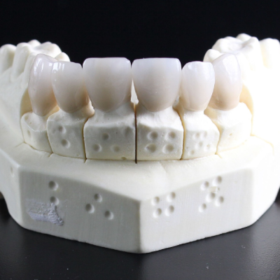 Dental Crown Bridges Dentures